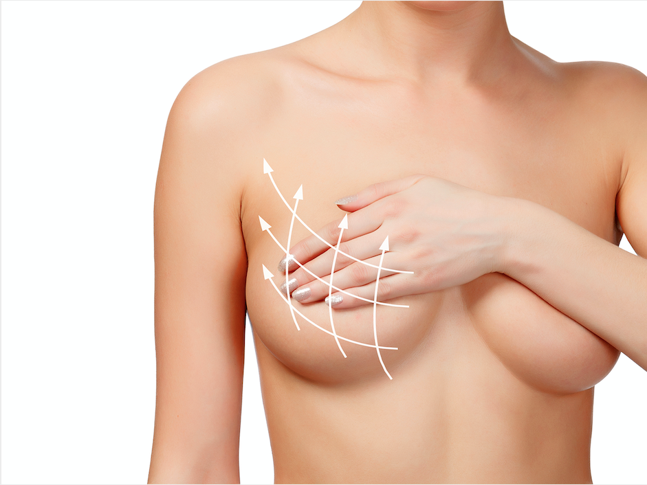 aumento, reducción y lifting de mamas
