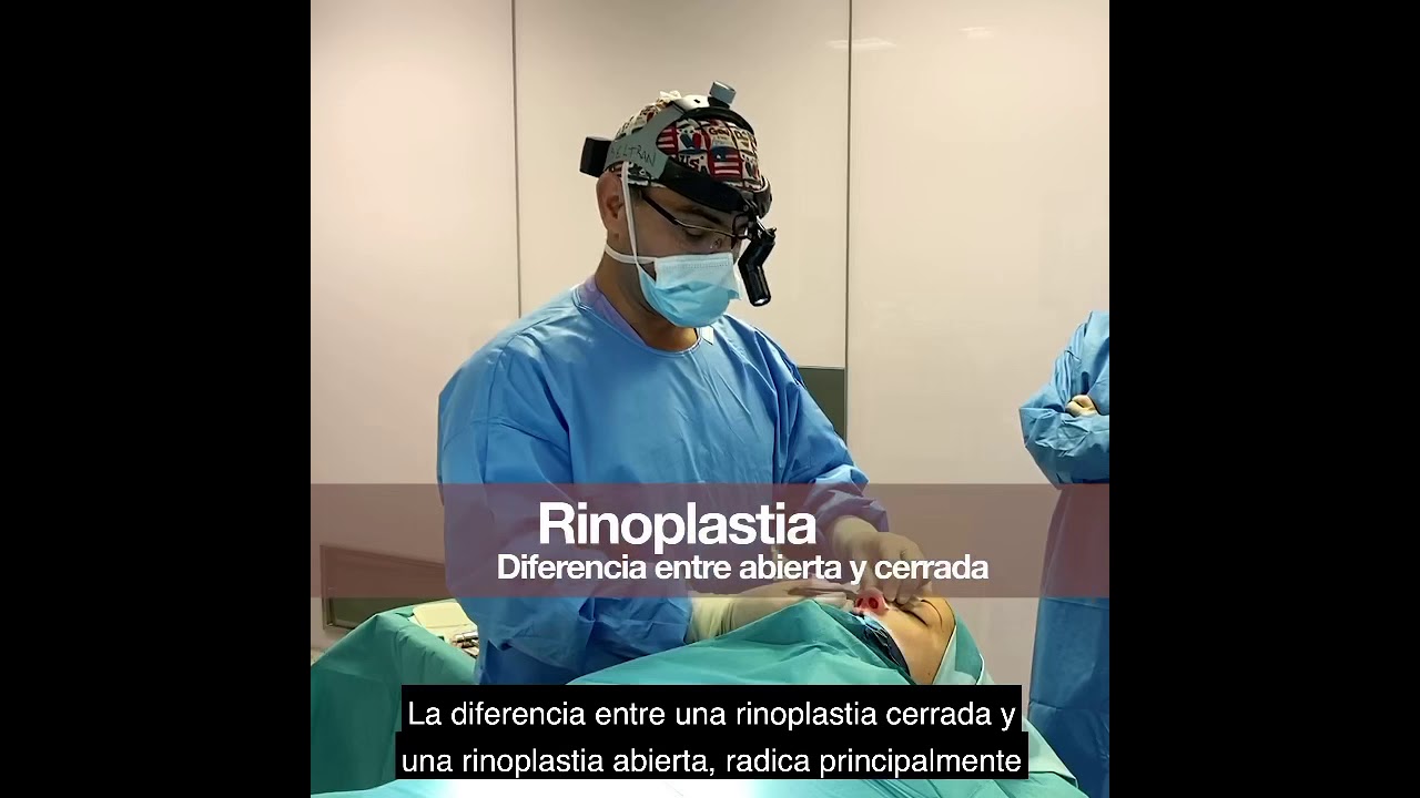 RINOPLASTIA. Diferencia entre abierta y cerrada.
