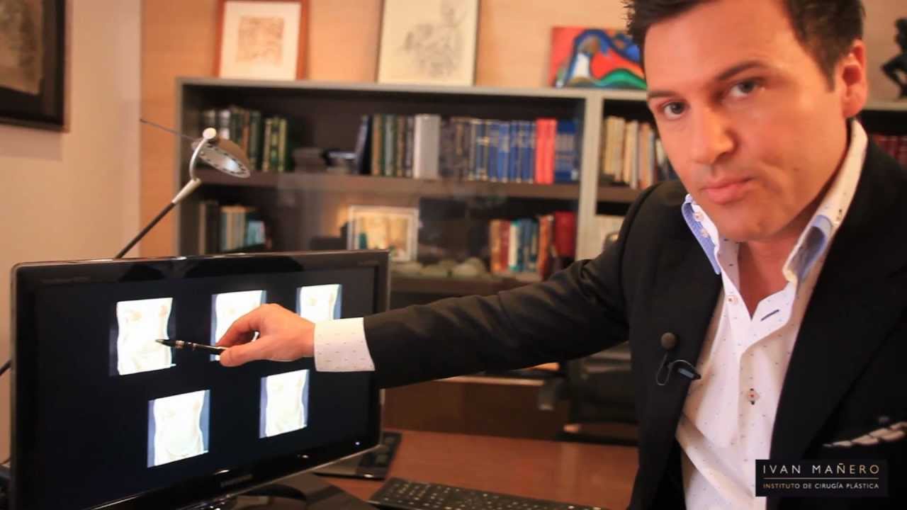 Resuelve tus dudas sobre abdominoplastia con el Dr. Iván Mañero