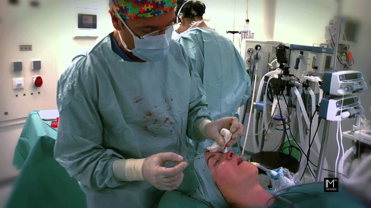 RINOPLASTIA con Dr. Ivan Mañero