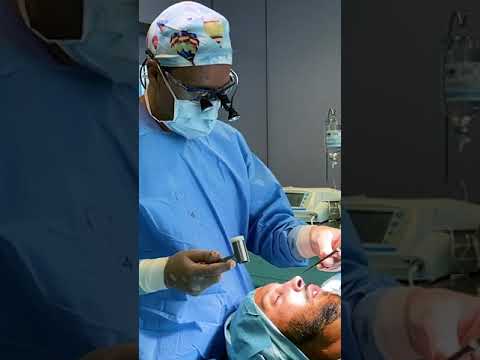 Rinoplastia Ultrasónica