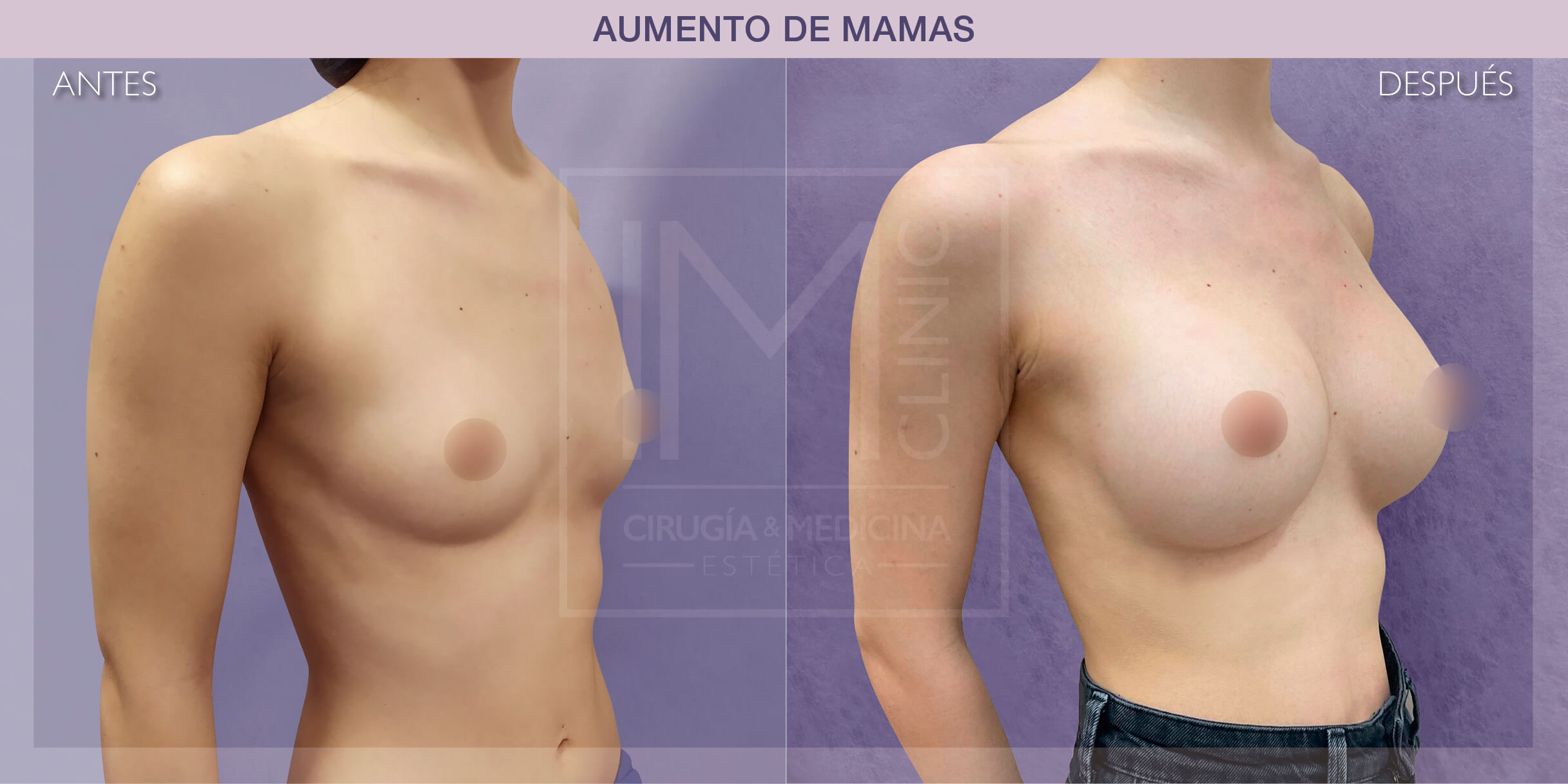 CENSURA