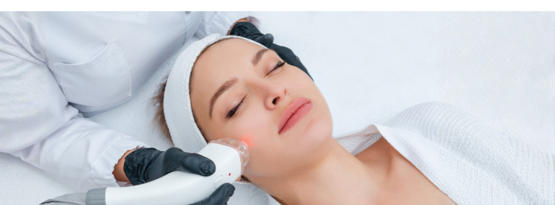 Cómo eliminar las patas de gallo