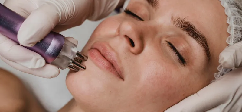 polinucleotidos-facial